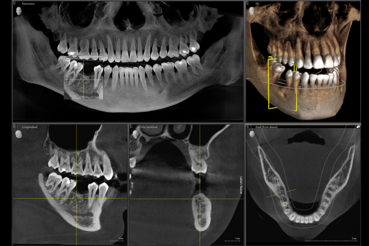 Dental 3D Scan