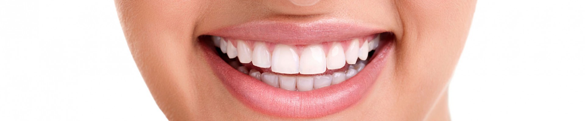 Tetracycline teeth discoloration or dark teeth